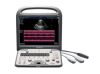 SONOSCAPE S8V Portable Color Doppler System Ultrasound - OB / GYN