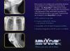 MINXRAY HF 120/60HPPWV Powerplus Portable X-Ray