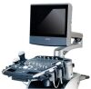 ALPINION ecube 9 Ultrasound - Cardiac - Vascular