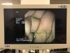 OLYMPUS EU-ME1 Endoscopy Processor