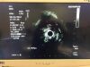 OLYMPUS EU-ME1 Endoscopy Processor