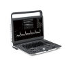 SONOSCAPE B/W Scanner E1 Ultrasound - OB / GYN
