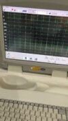 PHILIPS PageWriterTouch ECG unit