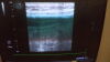 TOSHIBA PLT-704AT Ultrasound Transducer