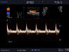ALOKA UST-5548 Ultrasound Transducer