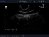 ALOKA UST-9118 Ultrasound Transducer