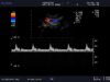 ALOKA UST-9118 Ultrasound Transducer