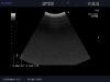 ALOKA UST-9130 Ultrasound Transducer