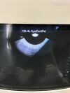 ATL C8-4v Endo Cavity Transducer OB / GYN