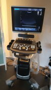 CHISON Qbit 7 Ultrasound - OB / GYN