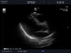 ALOKA UST-5299 Ultrasound Transducer