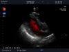 ALOKA UST-5299 Ultrasound Transducer