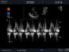 ALOKA UST-5299 Ultrasound Transducer