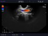 ALOKA UST-9124 Ultrasound Transducer