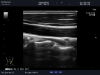 ALOKA UST-5413 Ultrasound Transducer