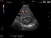 HITACHI EUP-B712 Ultrasound Transducer