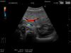 HITACHI EUP-C516 Ultrasound Transducer