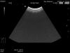 HITACHI EUP-C532 Ultrasound Transducer