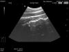 HITACHI EUP-C532 Ultrasound Transducer