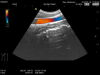 HITACHI EUP-C532 Ultrasound Transducer