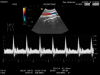 HITACHI EUP-C532 Ultrasound Transducer