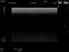 HITACHI EUP-L75 Ultrasound Transducer