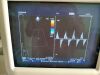 HITACHI S30T Ultrasound Transducer