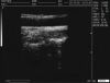 WELLD 2018 Ultrasound - OB / GYN