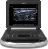SONOSITE Edge Ultrasound System