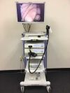 OLYMPUS CV 180 gastroscopy