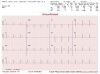 CARDIAC INSIGHT Cardea 20/20 Interpretive EKG Arrhythmia