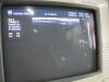 PHILIPS HDI L7-4 Linear Ultrasound Transducer
