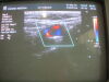 PHILIPS HDI L7-4 Linear Ultrasound Transducer