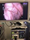 OLYMPUS CV-190 Endoscopy Processor