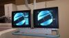 SIEMENS Polystar TOP with Polydoros SX 65/80 ANGIOGRAPHIE Rad/Fluoro Room