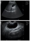 PLUSMED Color Doppler C5Plus Ultrasound - OB / GYN - Vascular