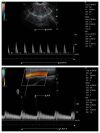 PLUSMED Color Doppler C5Plus Ultrasound - OB / GYN - Vascular