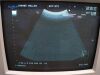 ALOKA UST-979 Ultrasound Transducer