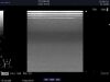 ALOKA UST-5415 Ultrasound Transducer