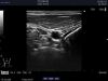 ALOKA UST-5415 Ultrasound Transducer