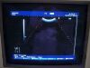 HITACHI C314G Ultrasound Transducer
