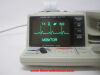 ZOLL PD1400 Defibrillator