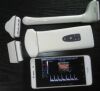 PLUSMED Wireless probe with changeable head available for android/ios/windows system Ultrasound Transducer