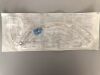 TELEFLEX MEDICAL Rusch Preformed AGT Nasal Endotracheal Tube 10/Bx 11781050