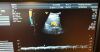 GE 4C-D Ultrasound Transducer