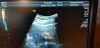 GE 4C-D Ultrasound Transducer
