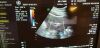 GE AB2-7-D Ultrasound Transducer