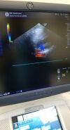GE M5S-D Ultrasound Transducer