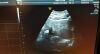 GE RAB2-5-D Ultrasound Transducer