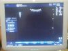 GE 4C-RC Ultrasound - OB / GYN